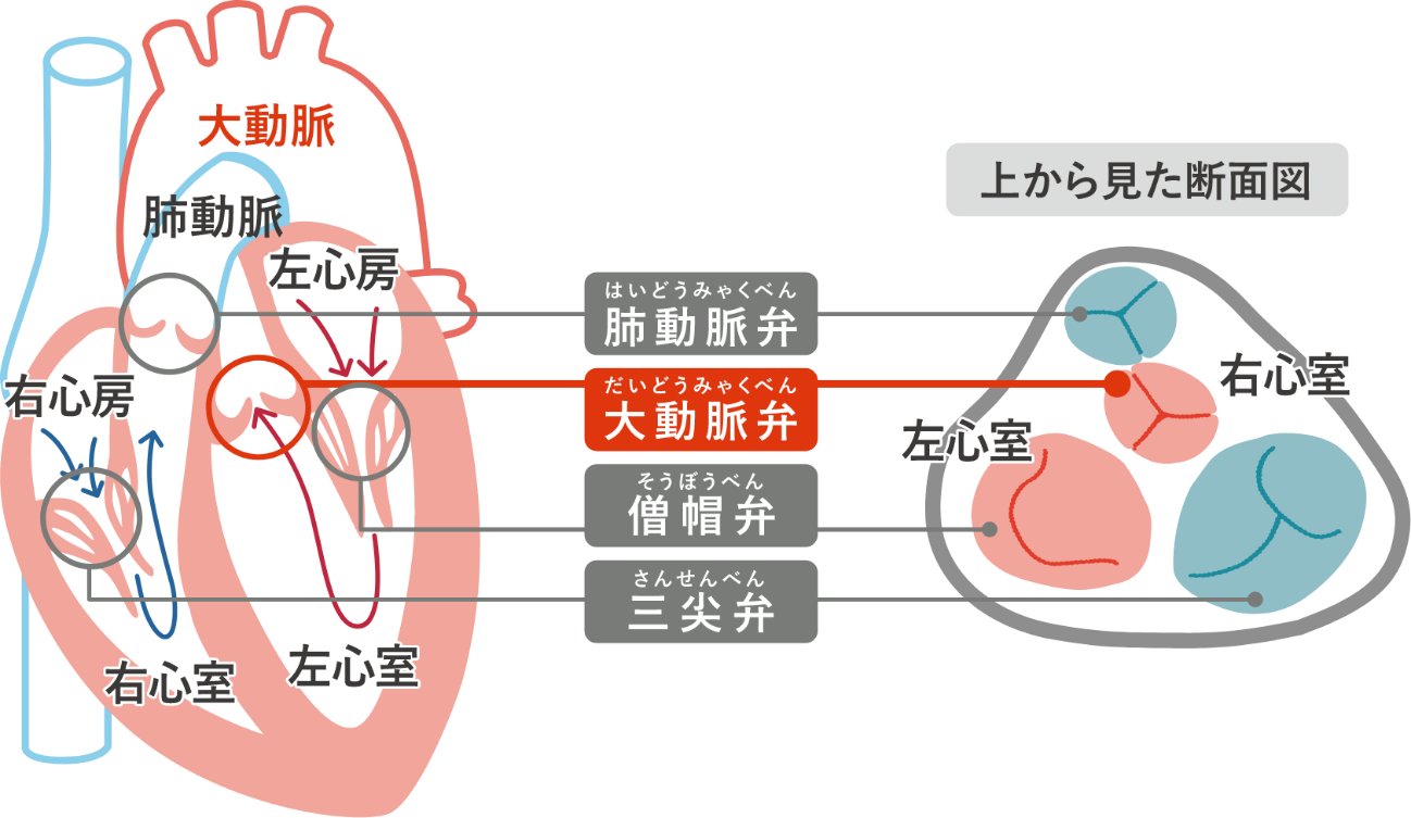 大動脈弁