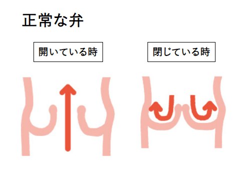 正常な弁